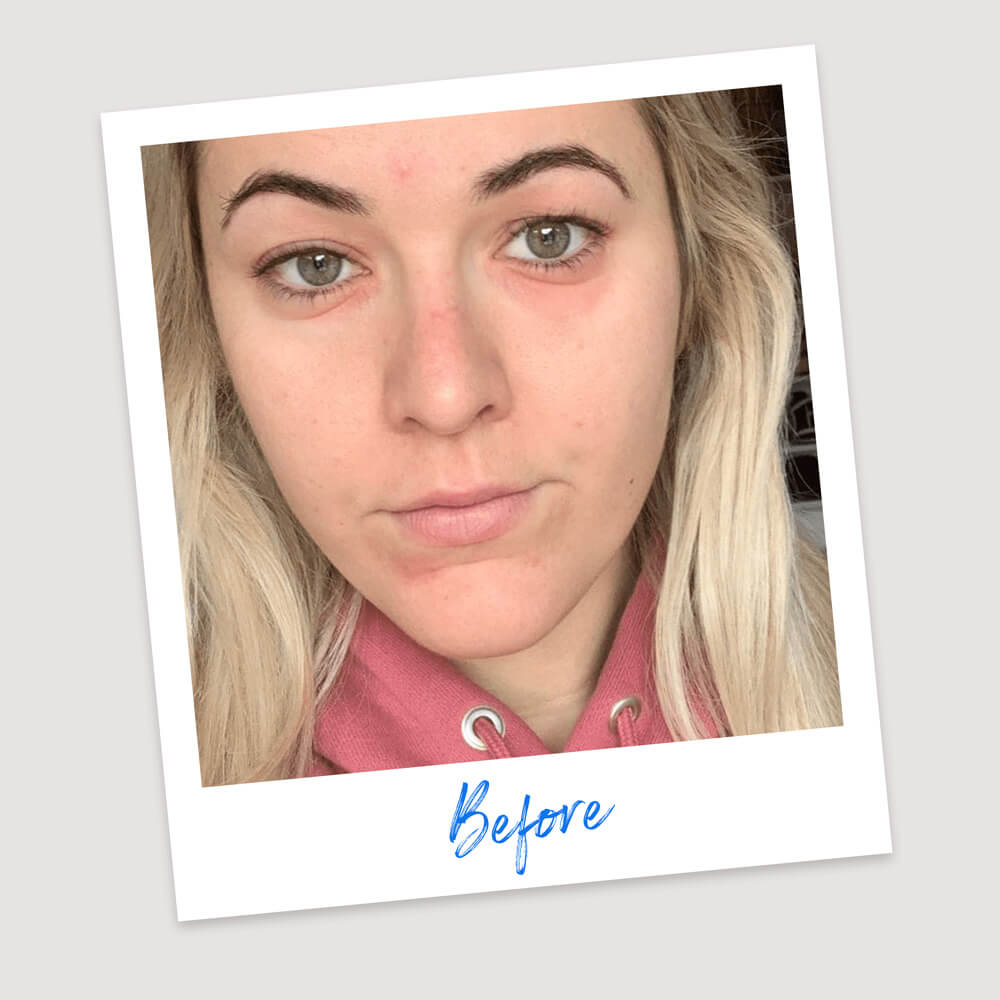 Results & Reviews | Koéna