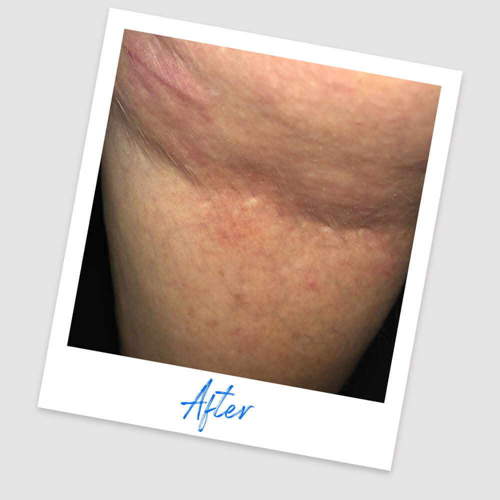 Results & Reviews | Koéna
