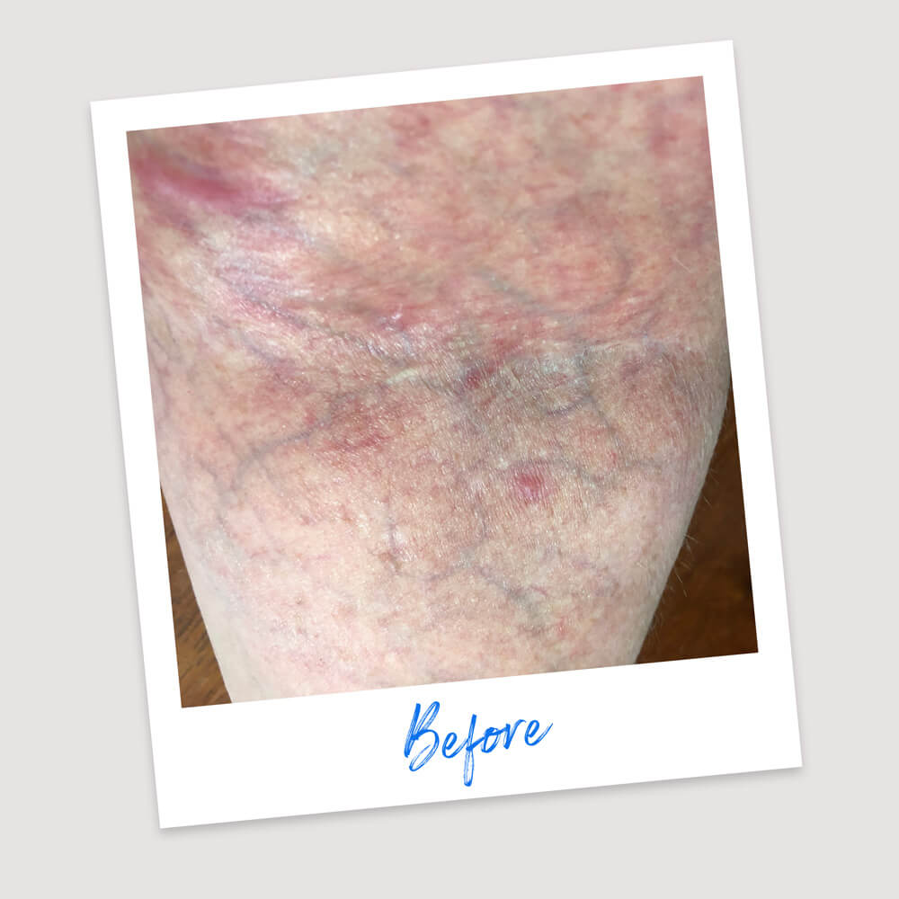 Results & Reviews | Koéna