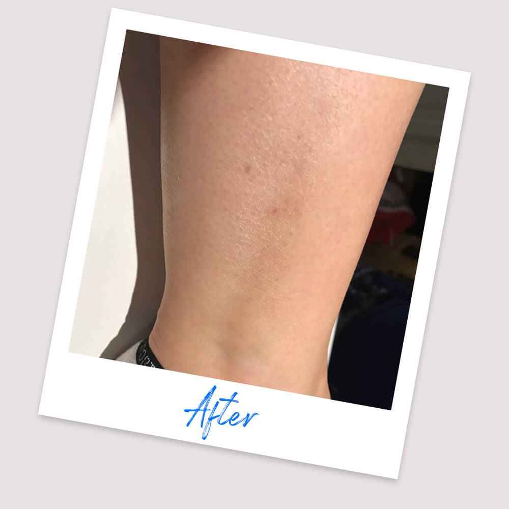 Results & Reviews | Koéna