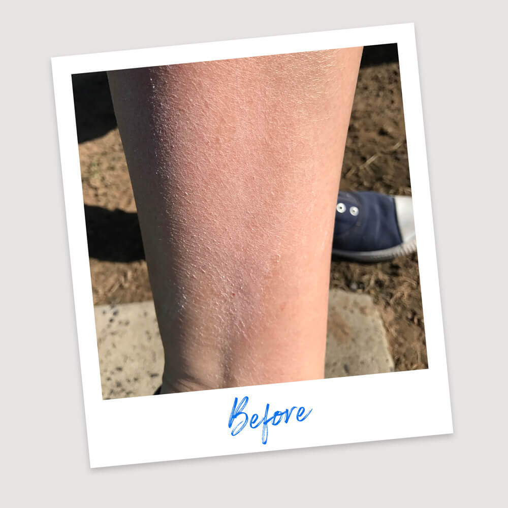 Results & Reviews | Koéna
