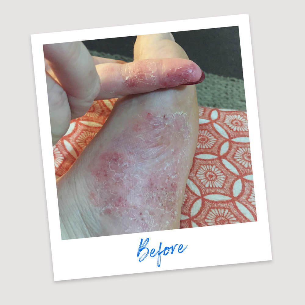 Results & Reviews | Koéna