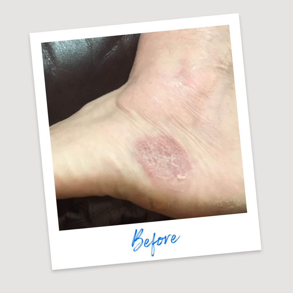 Results & Reviews | Koéna
