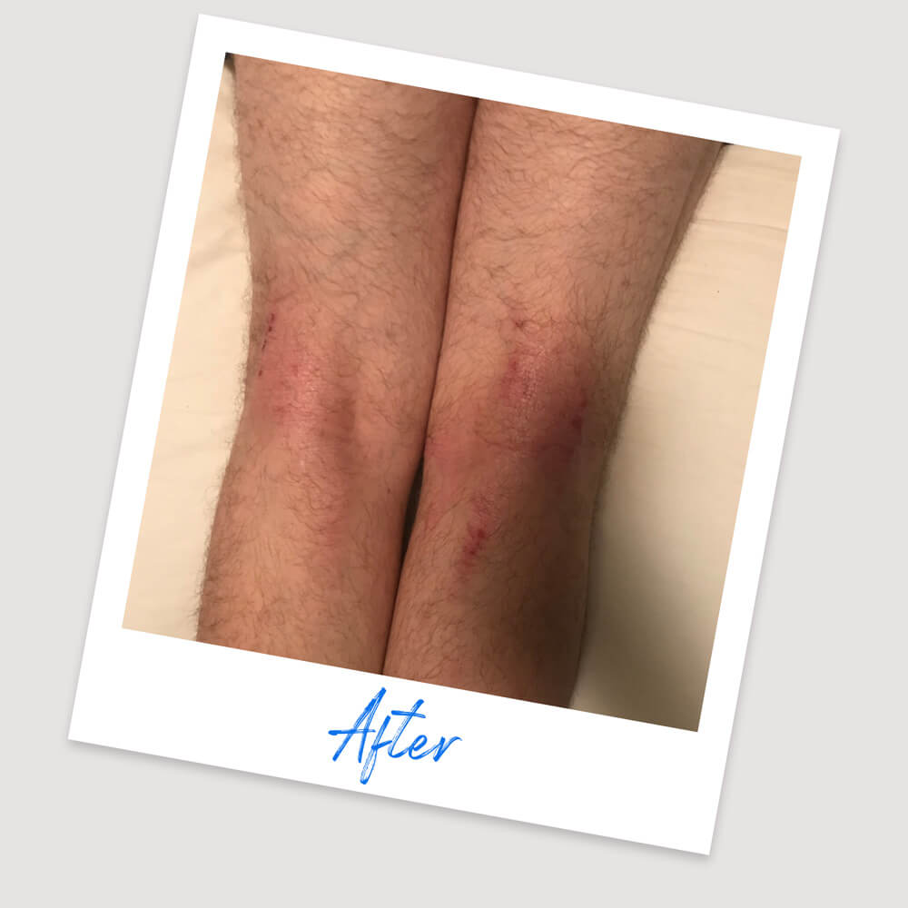 Results & Reviews | Koéna