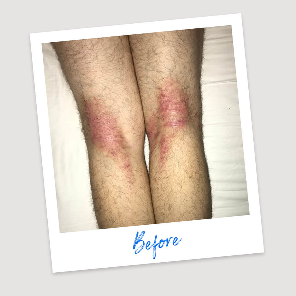 Results & Reviews | Koéna
