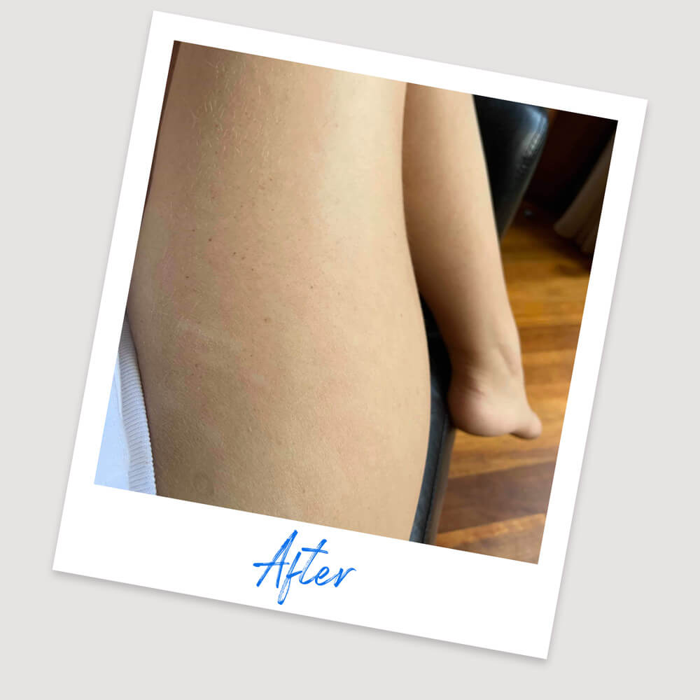 Results & Reviews | Koéna