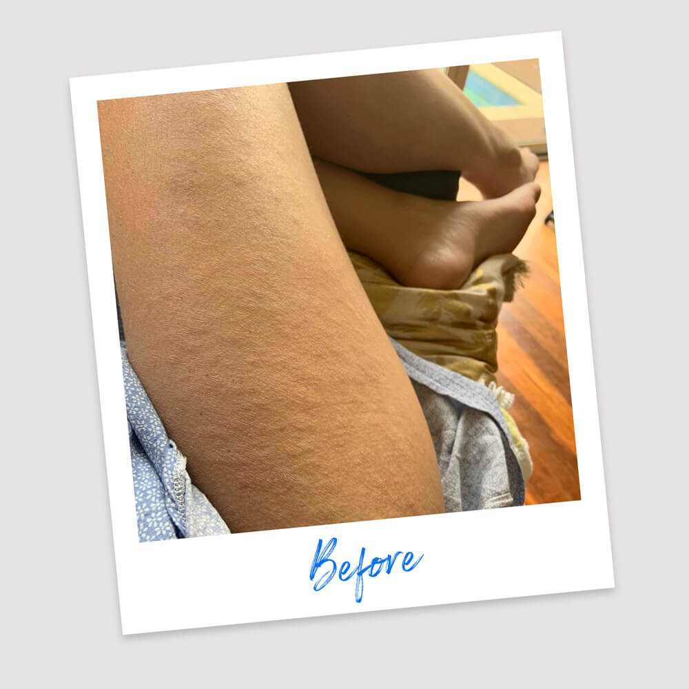 Results & Reviews | Koéna