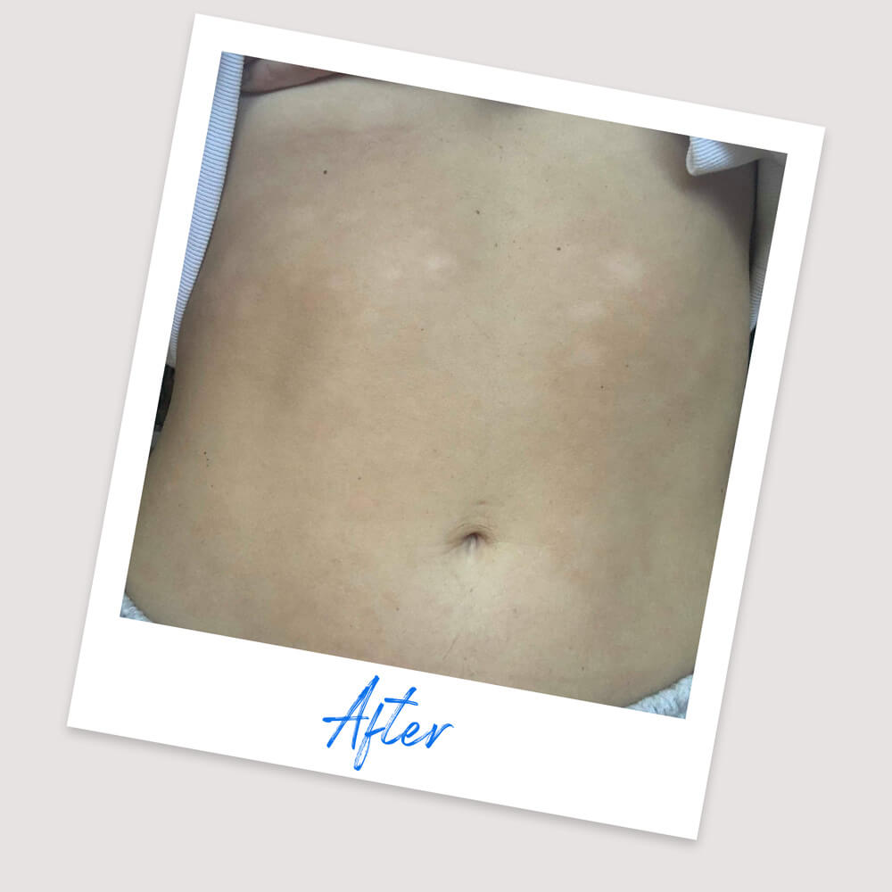 Results & Reviews | Koéna