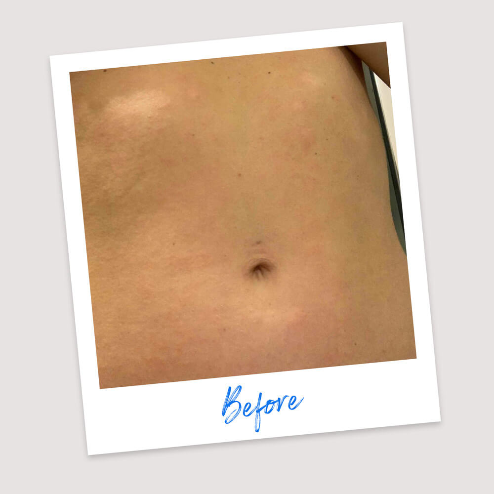 Results & Reviews | Koéna